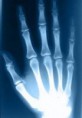 /album/fotogaleria-imagenologia/radiografia-de-mano-jpg/